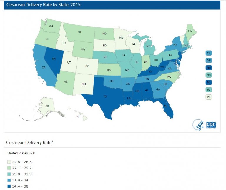 Where in the US to give birth naturally? Cesarean Statistics by State